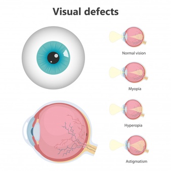 visual-disorders-treated-by-lasik-surgery-specialists